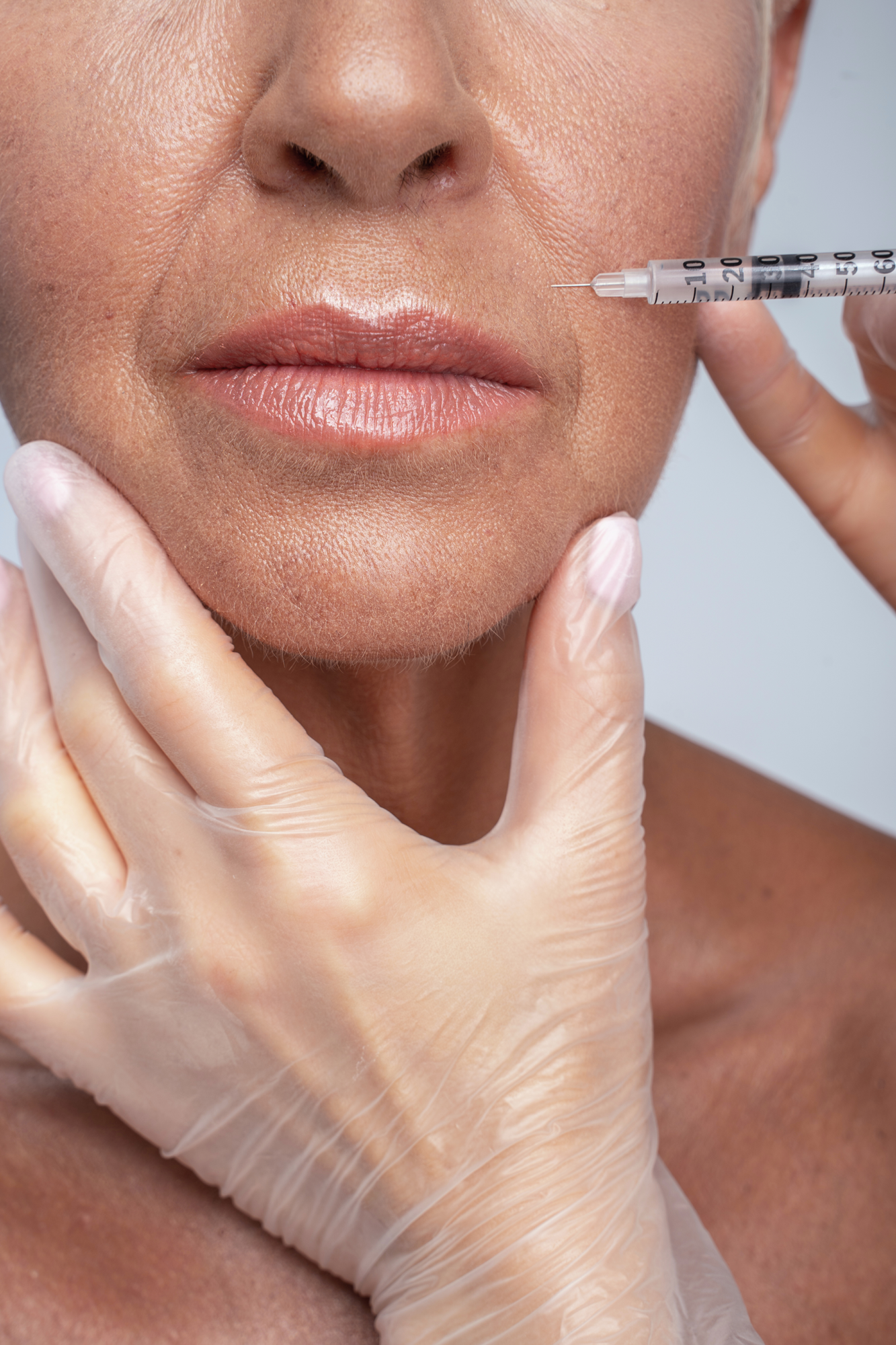 Mesobotox e microbotox Trattamenti Viso, Skin Quality e Acne, Centro Hermes Poliambulatorio Medico a Grosseto, Medicina e chirurgia estetica