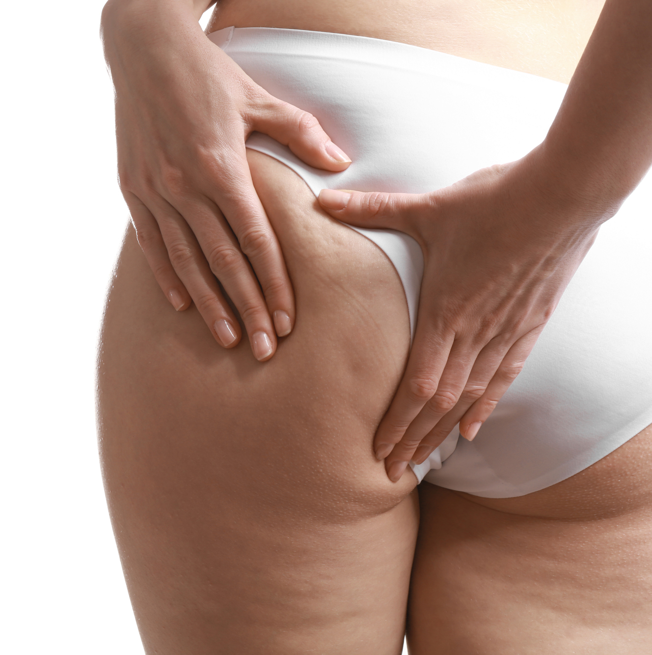 Trattamento della Cellulite a Grosseto. Centro Hermes propone trattamenti di Medicina Estetica Avanzata. Prenota la tua consulenza.